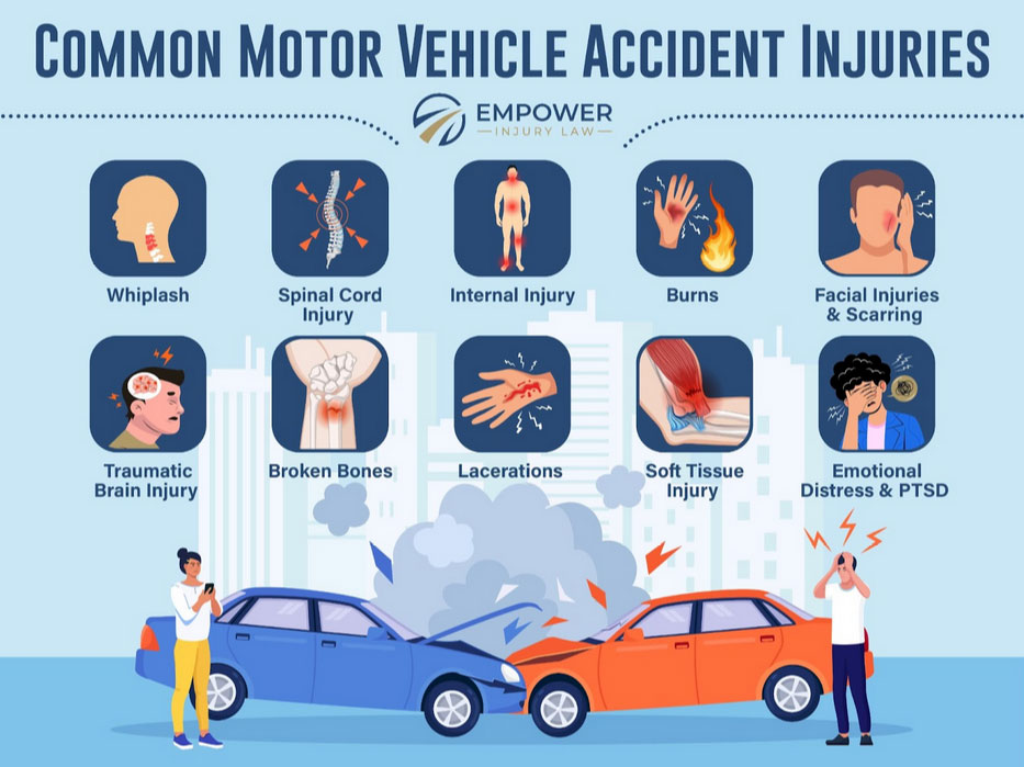 Motor Vehicle Accident Lawyer 100 Free Consult Call Now